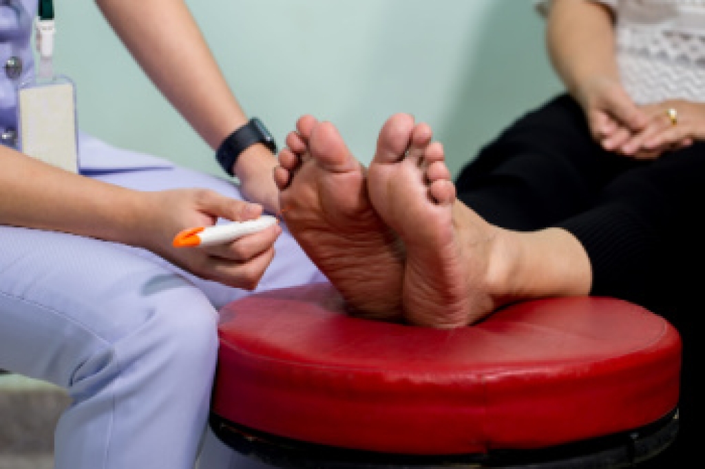 Nerve Damage to the Feet
